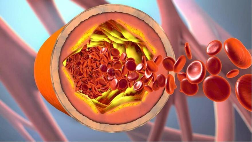 Menú Semanal para Bajar el Colesterol: Guía Completa y Ejemplo de Dieta